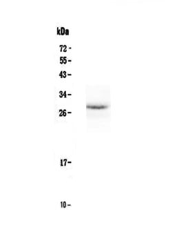 Epo Polyclonal Antibody:Antibodies, Polyclonal