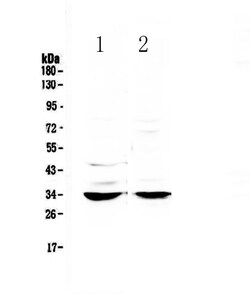 Invitrogen ERCC1 Polyclonal Antibody 100 &mu;g; Unconjugated:Antibodies,