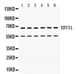 Invitrogen ERV3 Polyclonal Antibody 100 &mu;g; Unconjugated:Antibodies,
