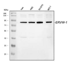 Invitrogen HERV Polyclonal Antibody 100 &mu;g; Unconjugated:Antibodies,