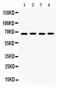 Invitrogen ETV4 Polyclonal Antibody 100 &mu;g; Unconjugated:Antibodies,