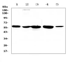 Invitrogen ETV6 Polyclonal Antibody 100 &mu;g | Buy Online | Invitrogen&trade; | Fisher Scientific