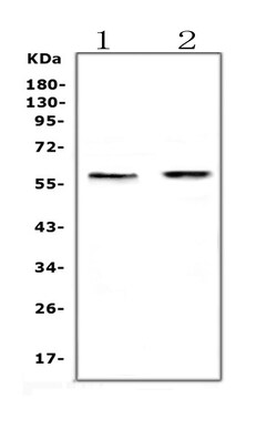 Invitrogen ETV6 Polyclonal Antibody 100 &mu;g | Buy Online | Invitrogen&trade; | Fisher Scientific