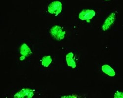 Invitrogen EWSR1 Polyclonal Antibody 100 &mu;g; Unconjugated:Antibodies,