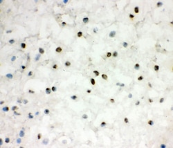 Invitrogen EWSR1 Polyclonal Antibody 100 &mu;g; Unconjugated:Antibodies,