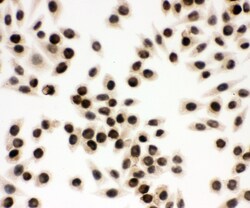 Invitrogen EWSR1 Polyclonal Antibody 100 &mu;g; Unconjugated:Antibodies,