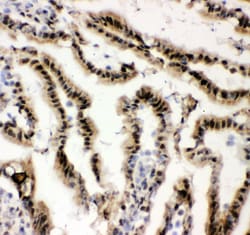 Invitrogen EWSR1 Polyclonal Antibody 100 &mu;g; Unconjugated:Antibodies,