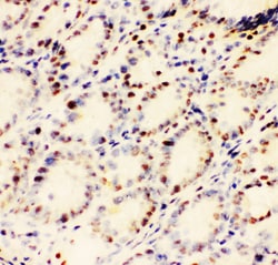 Invitrogen EWSR1 Polyclonal Antibody 100 &mu;g; Unconjugated:Antibodies,
