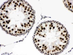 Invitrogen EWSR1 Polyclonal Antibody 100 &mu;g; Unconjugated:Antibodies,