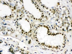 Invitrogen EWSR1 Polyclonal Antibody 100 &mu;g; Unconjugated:Antibodies,