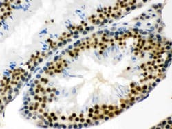 Invitrogen EWSR1 Polyclonal Antibody 100 &mu;g; Unconjugated:Antibodies,