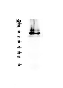 Invitrogen Prothrombin Polyclonal Antibody 100 &mu;g; Unconjugated:Antibodies,