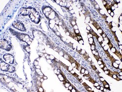 Invitrogen FABP2 Polyclonal Antibody 100 &mu;g; Unconjugated:Antibodies,
