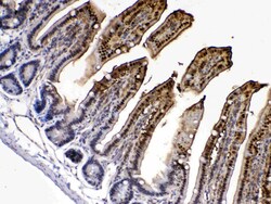 Invitrogen FABP2 Polyclonal Antibody 100 &mu;g; Unconjugated:Antibodies,