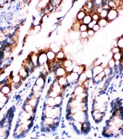 Invitrogen FABP5 Polyclonal Antibody 100 &mu;g; Unconjugated:Antibodies,