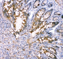 Invitrogen FABP5 Polyclonal Antibody 100 &mu;g; Unconjugated:Antibodies,