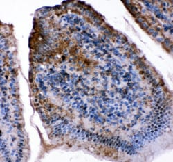 Invitrogen FABP5 Polyclonal Antibody 100 &mu;g; Unconjugated:Antibodies,