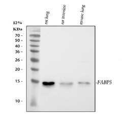 Invitrogen FABP5 Polyclonal Antibody 100 &mu;g; Unconjugated:Antibodies,