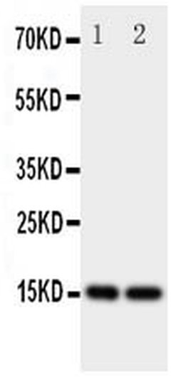 Invitrogen FABP5 Polyclonal Antibody 100 &mu;g; Unconjugated:Antibodies,