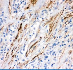 Invitrogen FAS (CD95) Polyclonal Antibody 100 &mu;g; Unconjugated:Antibodies,