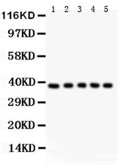 Invitrogen FAS (CD95) Polyclonal Antibody 100 &mu;g; Unconjugated:Antibodies,