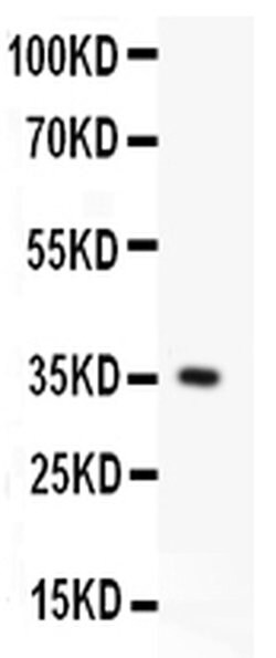 Invitrogen FAS (CD95) Polyclonal Antibody 100 &mu;g; Unconjugated:Antibodies,