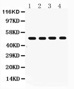 Invitrogen FAS (CD95) Polyclonal Antibody 100 &mu;g; Unconjugated:Antibodies,