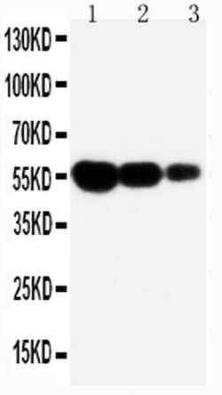 Invitrogen FAS (CD95) Polyclonal Antibody 100 &mu;g; Unconjugated:Antibodies,