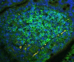 Invitrogen CD23 Polyclonal Antibody 100 &mu;g; Unconjugated:Antibodies,
