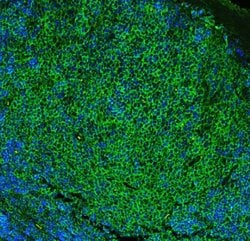 Invitrogen CD23 Polyclonal Antibody 100 &mu;g; Unconjugated:Antibodies,