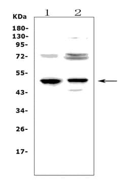 Invitrogen CD23 Polyclonal Antibody 100 &mu;g; Unconjugated:Antibodies,