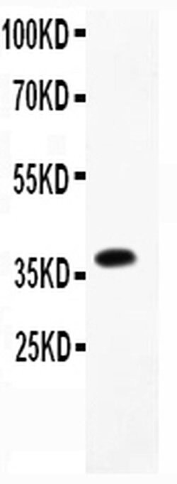 Invitrogen CD23 Polyclonal Antibody 100 &mu;g; Unconjugated:Antibodies,