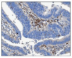 Invitrogen CD16 Polyclonal Antibody 100 &mu;g | Buy Online | Invitrogen&trade; | Fisher Scientific