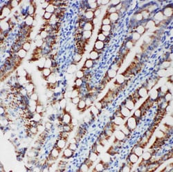 Invitrogen FER Polyclonal Antibody 100 &mu;g | Buy Online | Invitrogen&trade; | Fisher Scientific