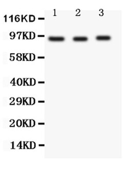 Invitrogen FER Polyclonal Antibody 100 &mu;g | Buy Online | Invitrogen&trade; | Fisher Scientific