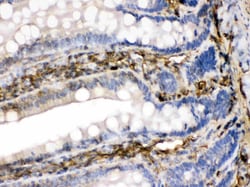 Invitrogen FGF1 Polyclonal Antibody 100 &mu;g; Unconjugated:Antibodies,