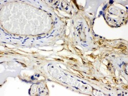 Invitrogen FGF1 Polyclonal Antibody 100 &mu;g; Unconjugated:Antibodies,