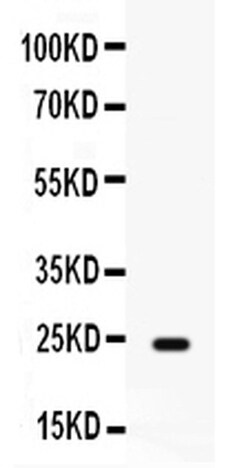 Invitrogen FGF1 Polyclonal Antibody 100 &mu;g; Unconjugated:Antibodies,