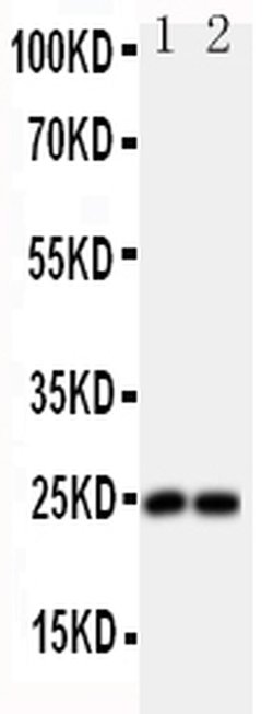 Invitrogen FGF19 Polyclonal Antibody 100 &mu;g; Unconjugated:Antibodies,
