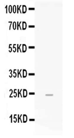 Invitrogen FGF19 Polyclonal Antibody 100 &mu;g; Unconjugated:Antibodies,