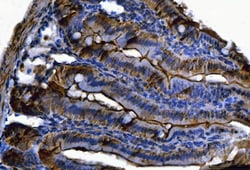 Invitrogen FGF19 Polyclonal Antibody 100 &mu;g; Unconjugated:Antibodies,