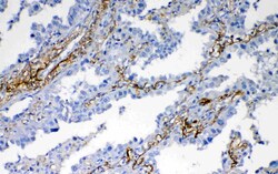 Invitrogen VEGFD Polyclonal Antibody 100 &mu;g; Unconjugated:Antibodies,