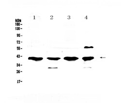 Invitrogen VEGFD Polyclonal Antibody 100 &mu;g; Unconjugated:Antibodies,