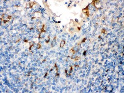 Invitrogen Filaggrin Polyclonal Antibody 100 &mu;g; Unconjugated:Antibodies,