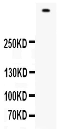 Invitrogen Filaggrin Polyclonal Antibody 100 &mu;g; Unconjugated:Antibodies,