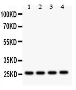 Invitrogen FLT3LG Polyclonal Antibody 100 &mu;g; Unconjugated:Antibodies,