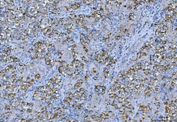 Invitrogen FMRP Polyclonal Antibody 100 &mu;g; Unconjugated:Antibodies,