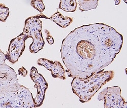 Invitrogen FosB Polyclonal Antibody 100 &mu;g; Unconjugated:Antibodies,