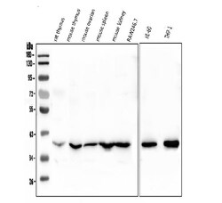Invitrogen FosB Polyclonal Antibody 100 &mu;g; Unconjugated:Antibodies,