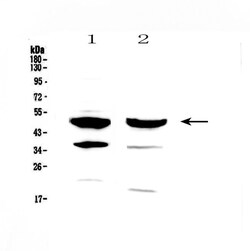 Invitrogen FOXA1 Polyclonal Antibody 100 μg; Unconjugated:Antibodies,